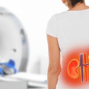 A woman holding her lower back, showing discomfort and symptoms of chronic inflammation.