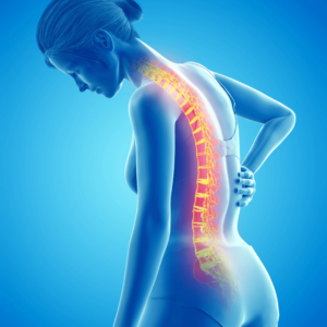 A digital illustration highlighting spinal inflammation in a woman, emphasizing chronic pain in the back.