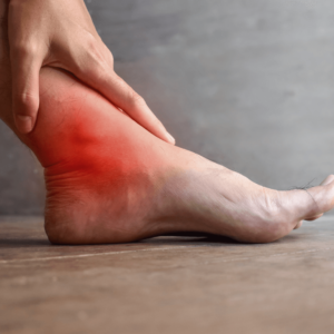 Close-up of a swollen and inflamed foot, representing joint inflammation and pain.